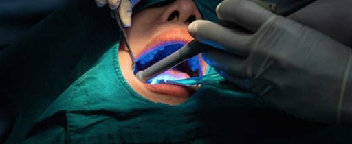 Cosmetic Dentist in London Bridge SE1 | Ethically Priced | Whites Dental