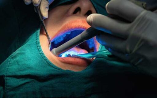 Invisalign in London | Whites Dental